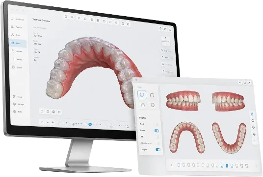 시스루 얼라이너 3D 치료 시뮬레이션 화면